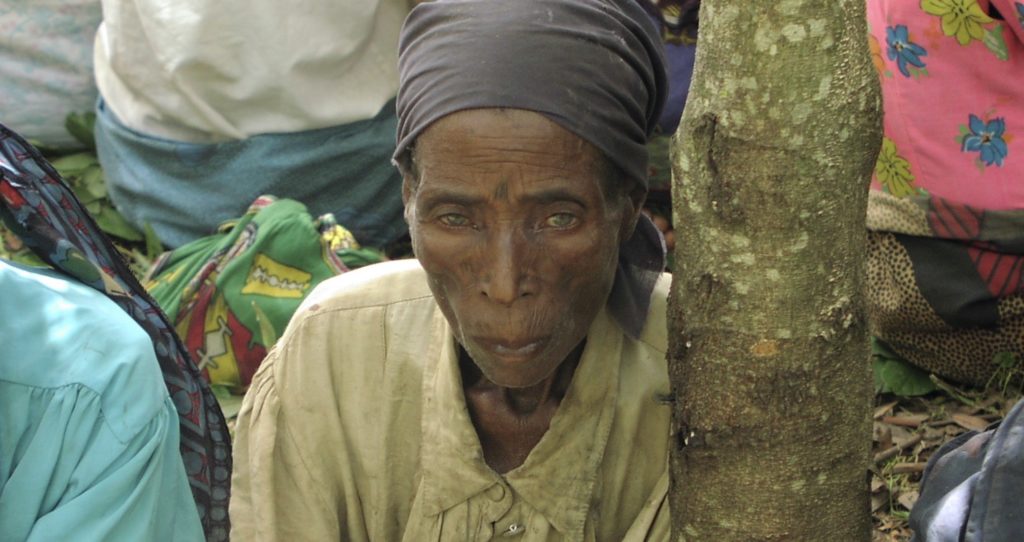 Elderly woman from Malawi